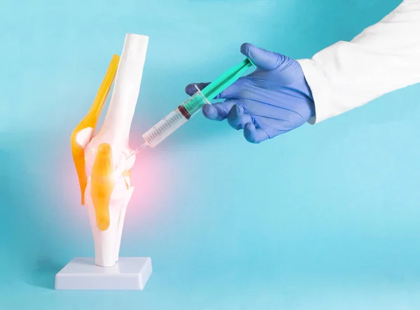 Stem Cell Therapy for Knee – Spine and Knee Clinic – Official website ...